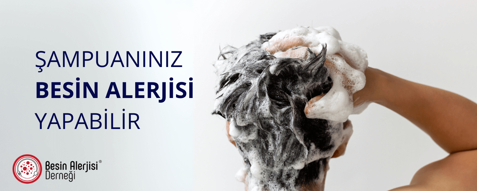 şampuan ve besin alerjisi