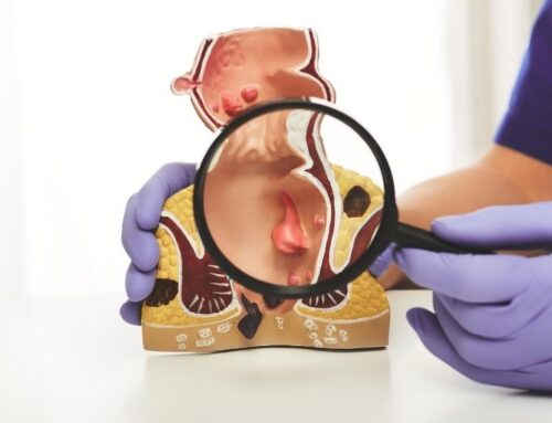 Eozinofilik gastrit belirtileri nelerdir?