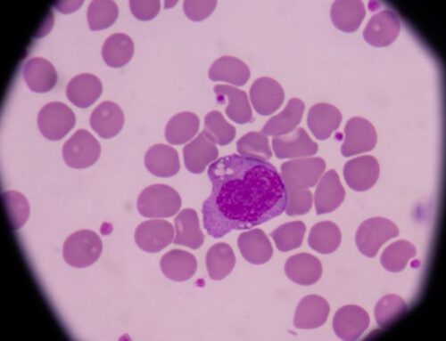 Eozinofilik gastrit teşhisi nasıl yapılır?