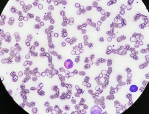 Eozinofilik gastroenterit belirtileri nelerdir?