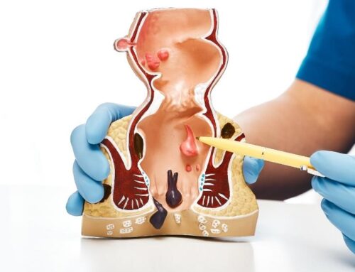 Eozinofilik gastroenterit teşhisi nasıl konulur?