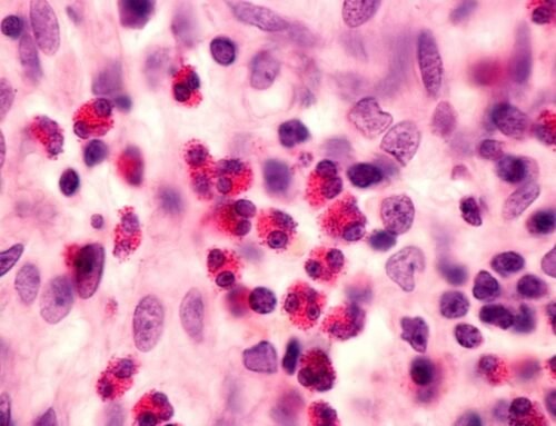 Eozinofilik kolit belirtileri nelerdir?