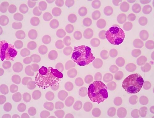 Eozinofilik kolit nedenleri nelerdir?