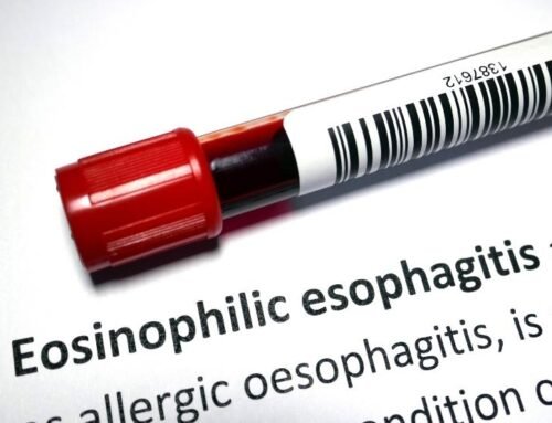 Eozinofilik kolit tedavisi nasıl yapılır?