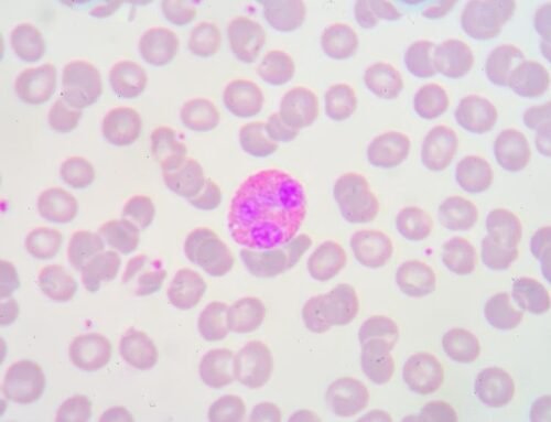 Eozinofilik kolit teşhisi nasıl konulur?