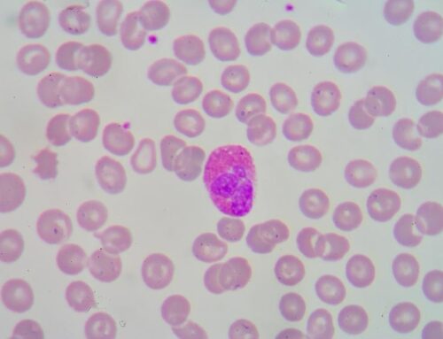 Eozinofilik özofajitte alerji testleri gerekir mi?