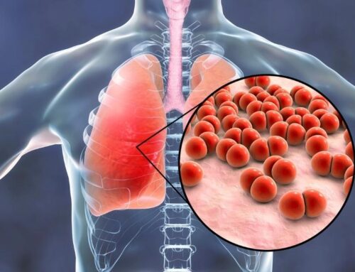 Zatürre İçin Hastanede Yatan Çocuk Ne Zaman Taburcu Edilmelidir?