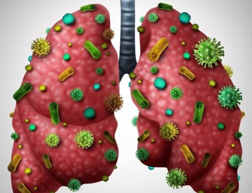 Zatürre Tedavisi Nasıl Yapılır?