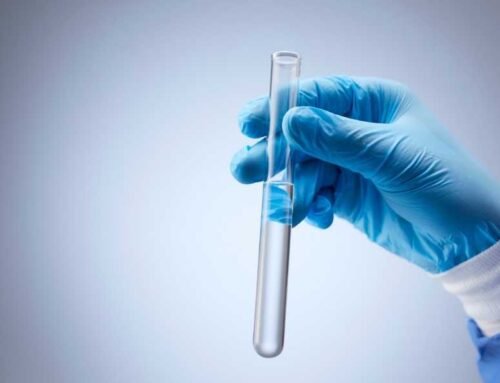 Besin Alerjisi İçin Tanı Testleri